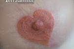 Areola tattoo scar camouflage - Terraderma Nanaimo