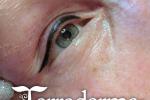 Eyeliner - Terraderma - Nanaimo Permanent Makeup 2024