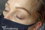 Nanaimo microbrows - June 2024 Terraderma