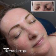 Permanent brows Terraderma 2023