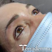 Terraderma 2022 Permanent Eyeliner Nanaimo