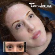 Permanent Brows Nanaimo BC - Terraderma 2023