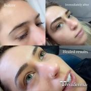 Permanent Brows Nanaimo - Terraderma 2022