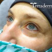 Permanent Makeup Eyeliner - Terraderma 2020