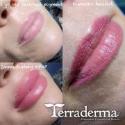 Vancouver island permanent Lip Blush - Terraderma Nanaimo BC 2022