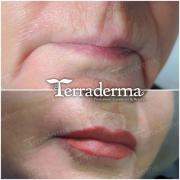 Lip Liner Permanent Makeup - Terraderma July 2020