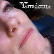 Lip tattoo Nanaimo - Terraderma 2024